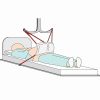 Pannus Apron Sling